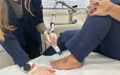 Estética “clean”: por que mais jovens estão removendo tatuagens e adotando uma beleza minimalista Medica dermatologista tem observado um aumento significativo na procura por remocao de tatuagens entre pacientes de 25 a 30 anos Foto Cadore Divulgacao